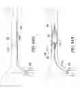 Fig. 47 - CLOT RETRIEVAL SYSTEM