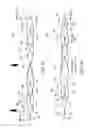 Fig. 96 - CLOT RETRIEVAL SYSTEM
