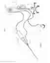 Fig. 02 - Systems and methods to modify intravascular lesions