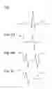 Fig. 04 - NAVIGATION AND TISSUE CAPTURE SYSTEMS AND METHODS