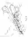 Fig. 03 - Surgical instrument with removable clamp arm assembly