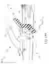 Fig. 18 - Surgical instrument with removable clamp arm assembly