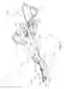 Fig. 04 - Surgical instrument with removable portion to facilitate cleaning