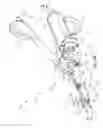 Fig. 16 - Surgical instrument with removable portion to facilitate cleaning