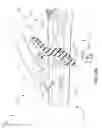 Fig. 19 - Surgical instrument with removable portion to facilitate cleaning