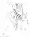 Fig. 20 - Surgical instrument with removable portion to facilitate cleaning