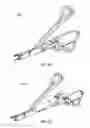 Fig. 34 - Surgical instrument with removable portion to facilitate cleaning