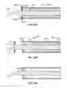 Fig. 37 - Surgical instrument with removable portion to facilitate cleaning