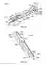 Fig. 40 - Surgical instrument with removable portion to facilitate cleaning