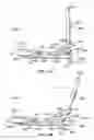 Fig. 44 - Surgical instrument with removable portion to facilitate cleaning