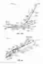 Fig. 45 - Surgical instrument with removable portion to facilitate cleaning