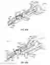 Fig. 47 - Surgical instrument with removable portion to facilitate cleaning