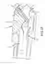 Fig. 03 - Pressure sensing of irrigant backpressure for aligning directional medical devices with target tissue