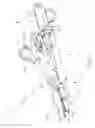 Fig. 04 - Surgical instrument with removable end effector components