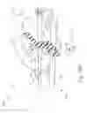 Fig. 19 - Surgical instrument with removable end effector components