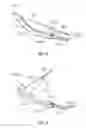 Fig. 67 - Surgical instrument with removable end effector components