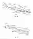 Fig. 70 - Surgical instrument with removable end effector components