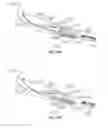 Fig. 71 - Surgical instrument with removable end effector components