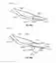 Fig. 79 - Surgical instrument with removable end effector components