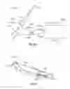 Fig. 82 - Surgical instrument with removable end effector components