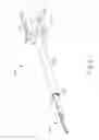 Fig. 07 - Surgical instrument with selectively actuated gap-setting features for end effector