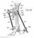 Fig. 28 - External fixator assembly