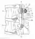 Fig. 01 - Device and system for fixing a spinal vertebra to a rod