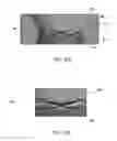 Fig. 20 - Wrist stabilization systems