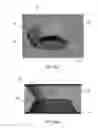 Fig. 21 - Wrist stabilization systems
