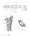 Fig. 25 - Wrist stabilization systems