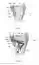Fig. 28 - Wrist stabilization systems
