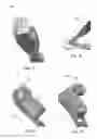 Fig. 32 - Wrist stabilization systems