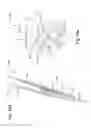 Fig. 22 - Electrosurgical pencil with sheath