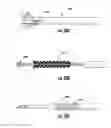 Fig. 15 - Microwave ablation catheter, handle, and system