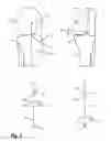 Fig. 04 - Method and device for determining geometric parameters for total knee replacement surgery
