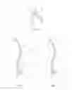 Fig. 02 - Methods, systems, and devices for designing and manufacturing a rod to support a vertebral column of a patient