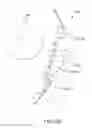 Fig. 45 - Arthroplasty jigs with mating accuracy
