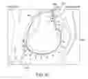 Fig. 63 - Arthroplasty jigs with mating accuracy