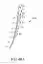 Fig. 69 - Arthroplasty jigs with mating accuracy