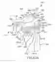 Fig. 76 - Arthroplasty jigs with mating accuracy