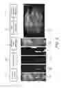 Fig. 04 - INTRA-PROCEDURAL ACCURACY FEEDBACK FOR IMAGE-GUIDED BIOPSY