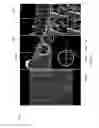 Fig. 16 - No-touch surgical navigation method and system thereof