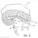 Fig. 03 - IMPLANT AND DELIVERY SYSTEM FOR NEURAL STIMULATOR