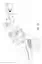 Fig. 32 - IMPLANT AND DELIVERY SYSTEM FOR NEURAL STIMULATOR