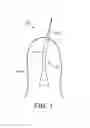 Fig. 02 - A SURGICAL DRAPE FOR TRANSFERRING DRIVE