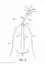 Fig. 03 - A SURGICAL DRAPE FOR TRANSFERRING DRIVE