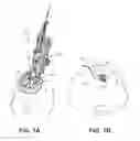 Fig. 02 - Medical device anchoring