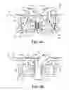 Fig. 07 - Medical device anchoring