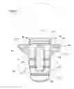 Fig. 01 - System of components or implements for easily and precisely installing a dental implant, and a method of installing the dental implant