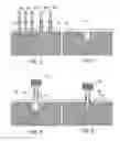 Fig. 04 - System of components or implements for easily and precisely installing a dental implant, and a method of installing the dental implant